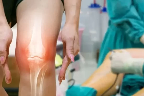 Ligamento Cruzado Anterior (LCA): Diagnóstico, Cirugía y Recuperación en Talca con el Dr. Gonzalo Rojas Castillo